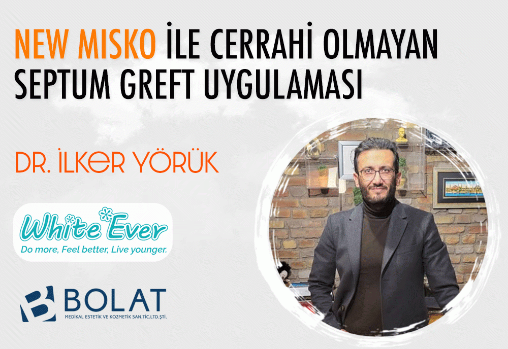 NEW MISKO İLE CERRAHİ OLMAYAN  SEPTUM GREFT UYGULAMASI