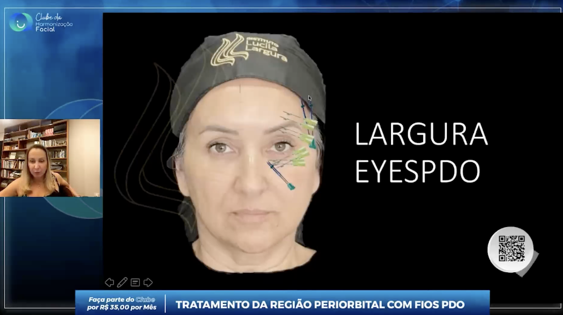 ME*** AC*** LT*** paylaşımı