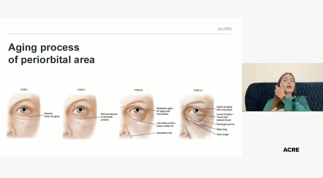 ME*** AC*** LT*** paylaşımı